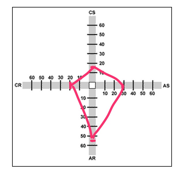 Quiz result showing higher score in abstract random thought range